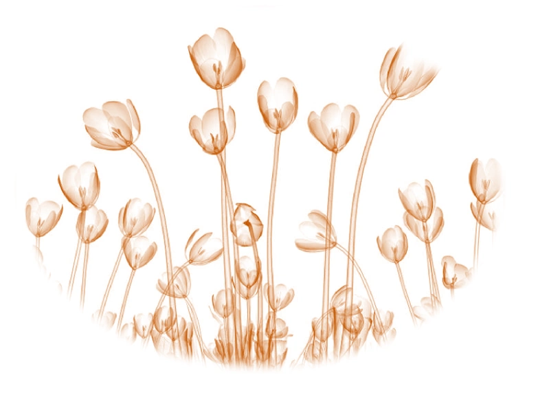 Tulipes